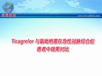 [ESC2009]Ticagrelor 与氯吡格雷在急性冠脉综合症患者中效果对比